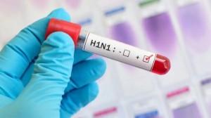 Surto de H1N1 em Goiás: Secretaria de Saúde cria grupo para acompanhar casos